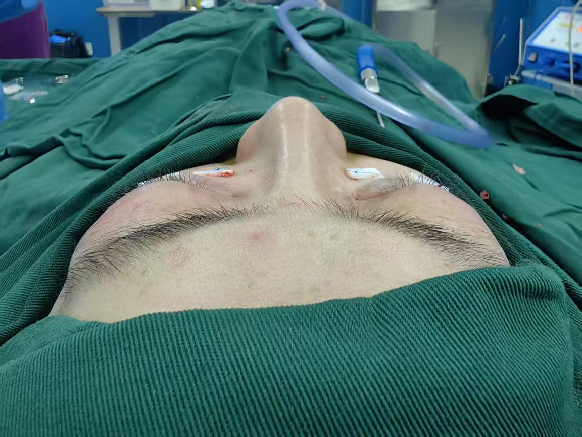 Postoperative photograph from the same actual case, in its original orientation without rotation