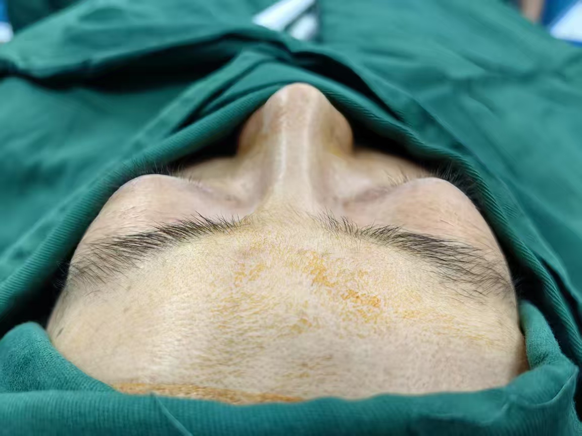 Preoperative photograph of an actual case, in its original orientation without rotation
